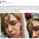 YTÜ’de Köpek Saldırısına Uğrayan Öğrenci Kafa Travması Geçirdi